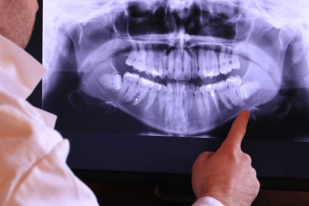 Best Emergency Gum Treatment in Powderly, TX