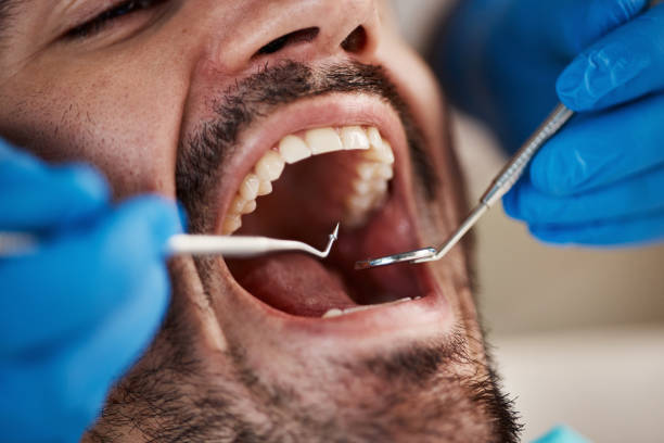 Best Emergency Tooth Extraction in Powderly, TX