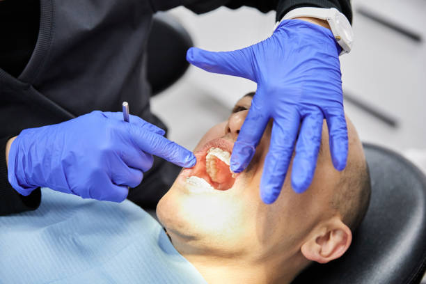 Best Emergency Treatment for Dental Infections or Abscesses in Powderly, TX
